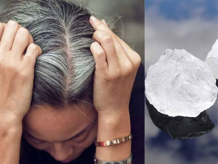 Hair Care: Apply this oil mixed with alum to get rid of dandruff, the skin will also become shiny. Hair Care:  ਡੈਂਡਰਫ ਦੇ ਖਾਤਮੇ ਲਈ ਫਿਟਕਰੀ 'ਚ ਮਿਲਾ ਕੇ ਲਗਾਓ ਇਹ ਤੇਲ, ਚਮੜੀ ਵੀ ਹੋ ਜਾਵੇਗੀ ਚਮਕਦਾਰ 