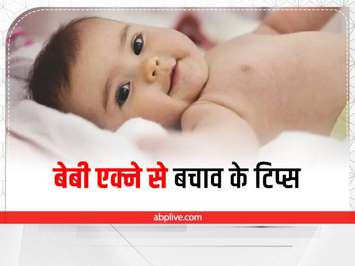 How to Cure Baby Acne and Cradle Cap in Hindi Baby Acne Cure: बच्चे के सिर पर पपड़ी बनना इस समस्या की हो सकती है निशानी, ऐसे करें बचाव