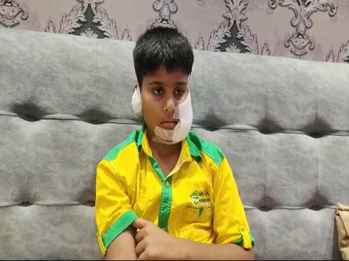 UP: Pitbull attacked a child playing in a park in Ghaziabad, got 200 stitches on his face ann Ghaziabad News: पिटबुल हुआ बेकाबू, पार्क में खेल रहे बच्चे पर किया जानलेवा हमला, चेहरे पर आए 200 टांके