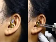 Watch video: பெண்ணின் காதுக்குள் புகுந்த குட்டி பாம்பு.. எடுக்க முடியாமல் தவித்த மருத்துவர்கள்..!