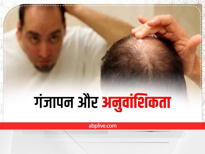 myths about hair loss specially in men why people think hair loss after 35 is uncommon Hair Fall in Men: 35 की उम्र तक जितने बाल गिरने हैं गिर जाएं, फिर नहीं गिरते! क्या ये बात पूरी तरह सच है?