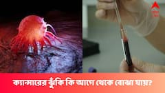 ক্যান্সারের ঝুঁকি কার কতটা আগে থেকে বলা যায়?
