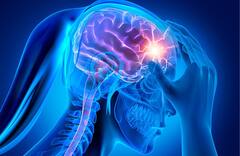 Migraine Awareness : ਸਿਰਫ  Headache ਦੀ ਤਰ੍ਹਾਂ ਟਰੀਟ ਕਰਦਿਆਂ ਗੰਭੀਰ ਬਿਮਾਰੀ ਨਾ ਬਣ ਜਾਵੇ ਮਾਈਗਰੇਨ, ਇਸ ਤਰ੍ਹਾਂ ਕਰੋ ਬਚਾਅ