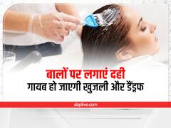 Hair Care: खुजली और डैंड्रफ चुटकियों में दूर, बालों में ऐसे लगाएं दही