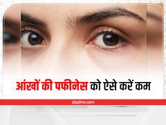 आंखों के नीचे की पफीनेस को इन मसाज के तरीकों से करें दूर, खूबसूरत दिखेंगी आंखें