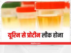 क्यों होती है यूरिन से प्रोटीन निकलने की समस्या, कैसे करें इसकी पहचान?
