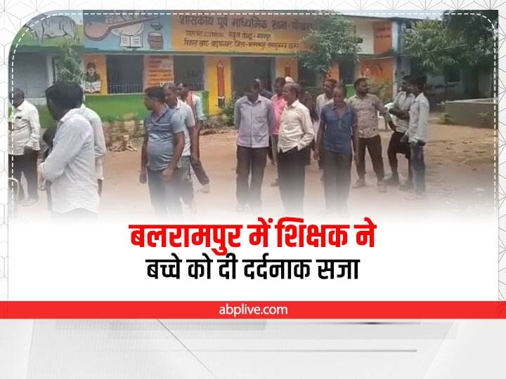 Chhattisgarh Balrampur teacher punish Pokhara Middle School student badly injured ANN Chhattisgarh News: बलरामपुर में बेरहम शिक्षक ने बच्चे को दी दर्दनाक सजा, पता चलने पर मच गया हंगामा