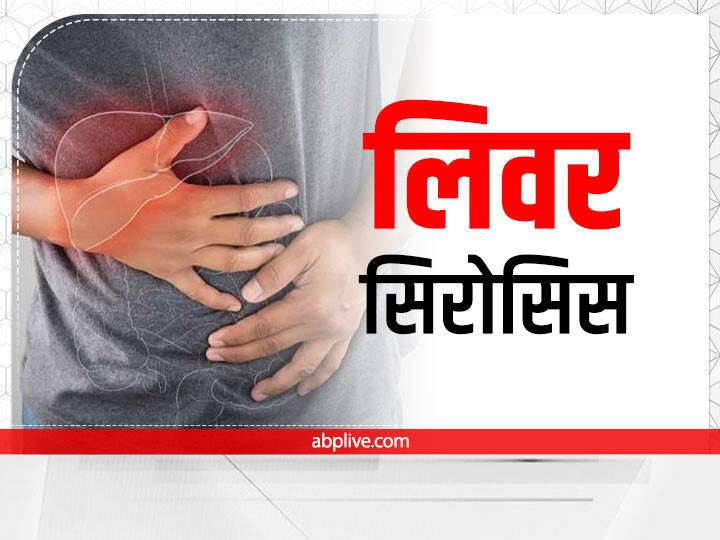 लीवर सिरोसिस को प्राकृतिक रूप से कैसे ठीक करें 1 e459cf1a7cc0ce94cc52819ef41fdd261663326094505429 original