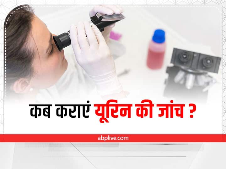 why urine test is must things to be kept in mind while getting urine test Urine Test Importance: क्यों जरूरी होती है यूरिन की जांच, किन बातों का रखना चाहिए ध्यान