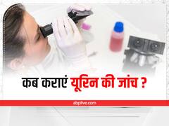 क्यों जरूरी होती है यूरिन की जांच, किन बातों का रखना चाहिए ध्यान?