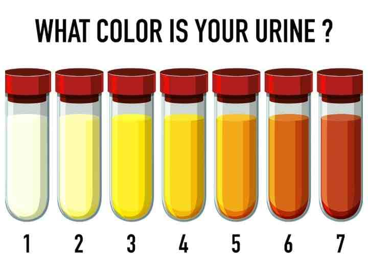 Urine Color What It Says About Your Health पेशाब के रंग से बीमारियों की हो सकती है पहचान, जानें किस रंग का यूरिन है सबसे ज्यादा खतरनाक