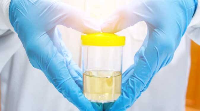 Urine Test Importance: Why it is necessary to pay attention to the urine test and how many things should be taken care of during the test Urine Test Importance : ਕਿਉਂ ਜ਼ਰੂਰੀ ਹੁੰਦੀ ਪਿਸ਼ਾਬ ਦੀ ਜਾਂਚ ਤੇ ਟੈਸਟ ਦੌਰਾਨ ਕਿੰਨਾ ਗੱਲਾਂ ਦਾ ਰੱਖਣਾ ਚਾਹੀਦਾ ਧਿਆਨ