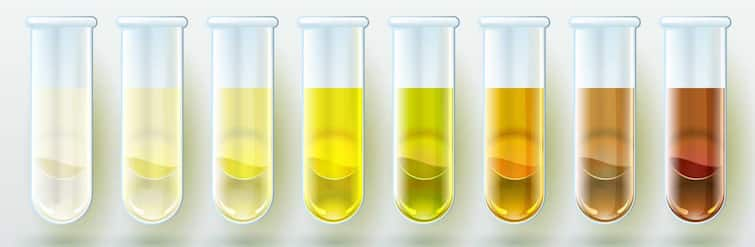 Urine Color : Identify the diseases that can be caused by the color of urine, know which color of urine is the most dangerous Urine Color :  ਪਿਸ਼ਾਬ ਦੇ ਰੰਗ ਤੋਂ ਹੋ ਸਕਦੀ ਬਿਮਾਰੀਆਂ ਦੀ ਪਛਾਣ, ਜਾਣੋ ਪਿਸ਼ਾਬ ਦਾ ਕਿਹੜਾ ਰੰਗ ਹੁੰਦੈ ਸਭ ਤੋਂ ਖ਼ਤਰਨਾਕ