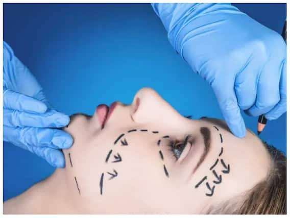 Cosmetic Surgery:: ਕੌਣ ਸੁੰਦਰ ਨਹੀਂ ਦਿਖਣਾ ਚਾਹੁੰਦਾ। ਬਹੁਤ ਘੱਟ ਲੋਕ ਹਨ ਜੋ ਸੁੰਦਰਤਾ ਦੇ ਪੈਮਾਨੇ 'ਤੇ ਫਿੱਟ ਹੁੰਦੇ ਹਨ, ਪਰ ਹੁਣ ਸਰਜਰੀ ਅਤੇ ਟ੍ਰਾਂਸਪਲਾਂਟ ਦੇ ਜ਼ਰੀਏ ਤੁਸੀਂ ਆਸਾਨੀ ਨਾਲ ਸੁੰਦਰ ਬਣ ਸਕਦੇ ਹੋ।