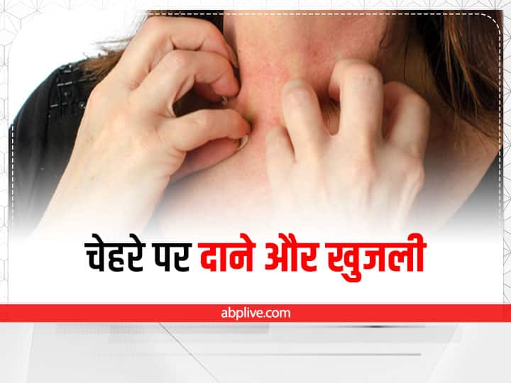 how to cure skin itching and rashes  Skin Cure Tips: चेहरे पर दाने बिगाड़ सकता है आपकी खूबसूरती, इन उपायों से झट से करें दूर