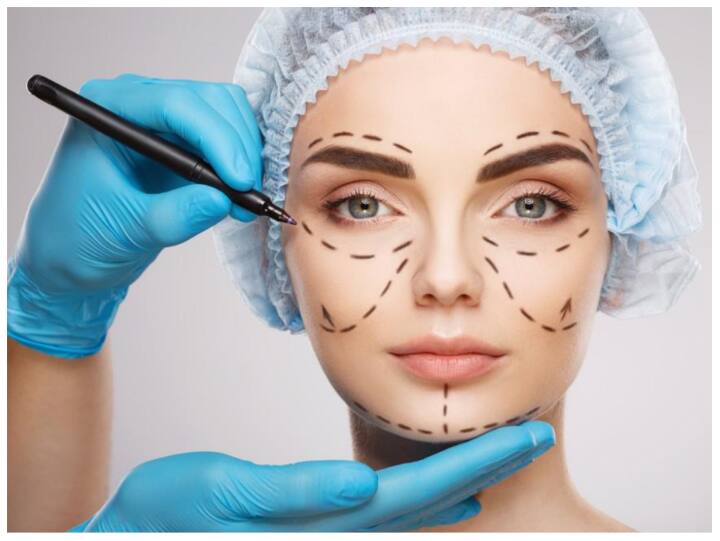 सुंदरता जरूरी नहीं है कि भगवान ही दे. आजकल लोग कॉस्मेटिक सर्जरी से भी खूबसूरती पा रहे हैं. आप लिप्स, नोज, कान और स्किन की सर्जरी करवा सकते हैं. अगर गंजे हो रहे हैं तो हेयर ट्रांसप्लांट करवा सकते हैं.