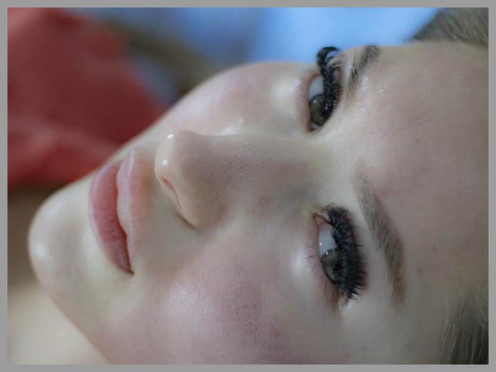 There are some tips to get rid of pimples quickly Acne: పండుగలు వచ్చేస్తున్నాయ్, మొటిమలు త్వరగా మానిపోవాలంటే ఇవిగో చిట్కాలు
