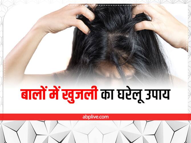 Home Remedies To Cure Head Itching | बालों को खुजला-खुजला कर हो रहे हैं  परेशान? राहत पाने के लिए अपनाएं ये टिप्स