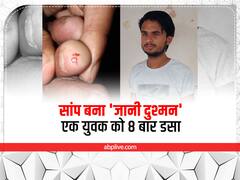 आगरा में सांप बना युवक का 'जानी दुश्मन', अब तक 8 बार डसा, जानें- क्या है पूरी कहानी