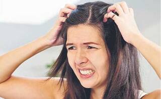 Hair Care Tips : ਵਾਲਾਂ 'ਚ ਲਗਾਤਾਰ ਹੋ ਰਹੀ ਖਾਰਸ਼ ਤੋਂ ਥੱਕ ਗਏ ਹੋ ! ਪਰੇਸ਼ਾਨ ਨਾ ਹੋਵੋ ; ਰਾਹਤ ਪਾਉਣ ਲਈ ਇਨ੍ਹਾਂ ਟਿਪਸ ਨੂੰ ਕਰੋ ਫਾਲੋ