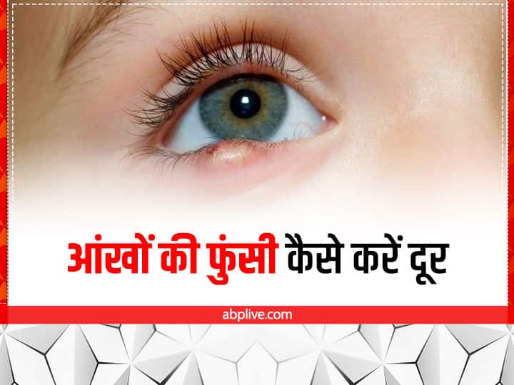 How To Get Rid Of A Stye With Ayurveda