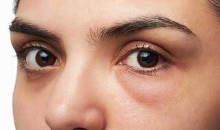 Health Tips : ਸਰੀਰ ਦੇ ਇਸ ਹਿੱਸੇ 'ਚ ਆ ਜਾਵੇ ਸੋਜ ਤਾਂ ਭੁੱਲ ਕੇ ਵੀ ਨਾ ਕਰੋ ਨਜ਼ਰਅੰਦਾਜ਼, ਹੋ ਸਕਦੇ ਗੰਭੀਰ ਬਿਮਾਰੀ ਦੇ ਲੱਛਣ