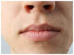 नाक का सूखापन कर सकता है आपको परेशान, आजमाएं ये टिप्स