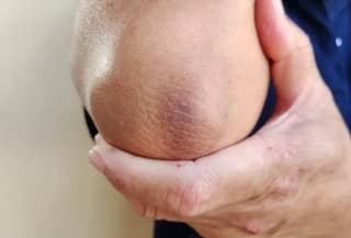 Skin Care Tips :  ਗਰਦਨ ਅਤੇ ਕੂਹਣੀ ਦਾ ਕਾਲਾਪਨ ਦੂਰ ਕਰ ਦੇਣਗੇ ਦਾਦੀ ਮਾਂ ਦੇ ਇਹ ਨੁਸਖੇ, ਇੱਕ ਵਾਰ ਜ਼ਰੂਰ ਅਜ਼ਮਾਓ