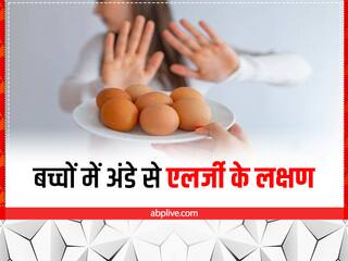 Egg Allergy: अंडा खाते ही बच्चा बीमार पड़ता है तो हो सकती है एग से एलर्जी, ये हैं लक्षण