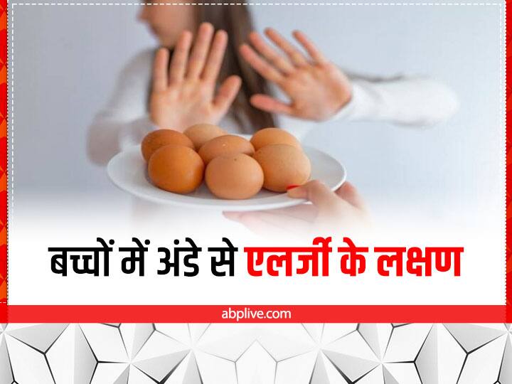 Symptoms Of Egg Intolerance Egg Allergy Treatment In Children Egg Allergy In Baby Egg Allergy: अंडा खाते ही बच्चा बीमार पड़ता है तो हो सकती है एग से एलर्जी, ये हैं लक्षण