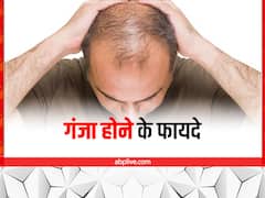 गंजेपन का भी है अलग स्वैग, सेहत को पहुंचाते हैं कई फायदे