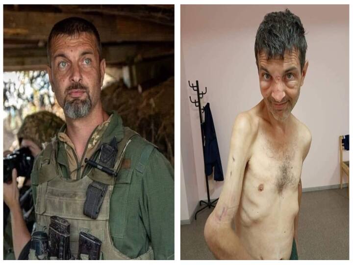 Ukraine Releases Shocking Before And After Pictures Of Soldier Captured By Russians Ukraine Soldier Pic : ரஷ்யா விடுவித்த உக்ரைன் வீரர்.. புகைப்படத்தை வெளியிட்டு உக்ரைன் கொடுத்த தகவல் என்ன தெரியுமா?