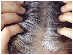 Covid19 Symptoms Hair Loss: तेजी से बढ़ रहे हैं सफेद बाल, हो सकते हैं कोरोना के साइड इफेक्ट्स
