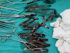 मुजफ्फरनगर में आदमी के पेट से निकाले गए 63 स्टील के चम्मच, आईसीयू में भर्ती