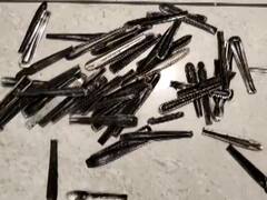 Doctors Remove 62 Steel Spoons From Man's Stomach In Muzaffarnagar After Patient Complains Of Severe Pain