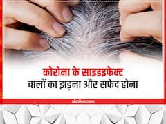 Covid19 Symptoms Hair Loss: तेजी से बढ़ रहे हैं सफेद बाल, हो सकते हैं कोरोना के साइड इफेक्ट्स