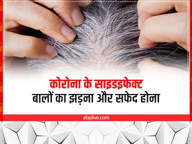 Long Covid19 Symptoms Hair Loss After Covid-19 Grey Hair After Corona How To Stop Grey Hair | Covid19 Symptoms Hair Loss: तेजी से बढ़ रहे हैं सफेद बाल, हो सकते हैं कोरोना Long Covid19 Symptoms Hair Loss After Covid-19 Grey Hair After Corona How To Stop Grey Hair | Covid19 Symptoms Hair Loss: तेजी से बढ़ रहे हैं सफेद बाल, हो सकते हैं कोरोना