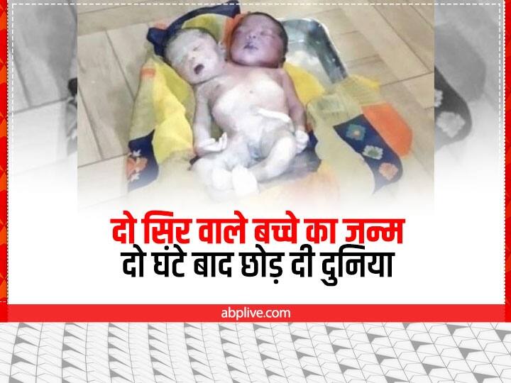Chhattisgarh Manendragarh-Chirmiri-Bharatpur woman give birth two-headed baby boy ANN Chhattisgarh News: छत्तीसगढ़ में महिला ने दिया दो सिर वाले बच्चे को जन्म, देखने के लिए उमड़ी लोगों की भीड़