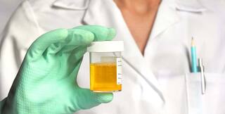 Urine Pass : ਇੱਕ ਦਿਨ 'ਚ ਕਿੰਨੇ ਮਿਲੀਲੀਟਰ ਪਿਸ਼ਾਬ ਕਰਦੇ ਨੇ ਆਮ ਲੋਕ, ਕੀ ਘੱਟ ਪਿਸ਼ਾਬ ਆਉਣ ਨਾਲ ਵੀ ਹੋ ਸਕਦੀਆਂ ਨੇ ਬਿਮਾਰੀਆਂ ?