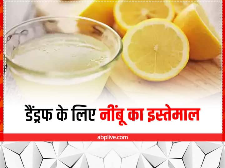 how to get rid of dandruff With Lemon Lemon for Dandruff: नींबू से करें डैंड्रफ की समस्या दूर, इन तरीकों से करें इस्तेमाल