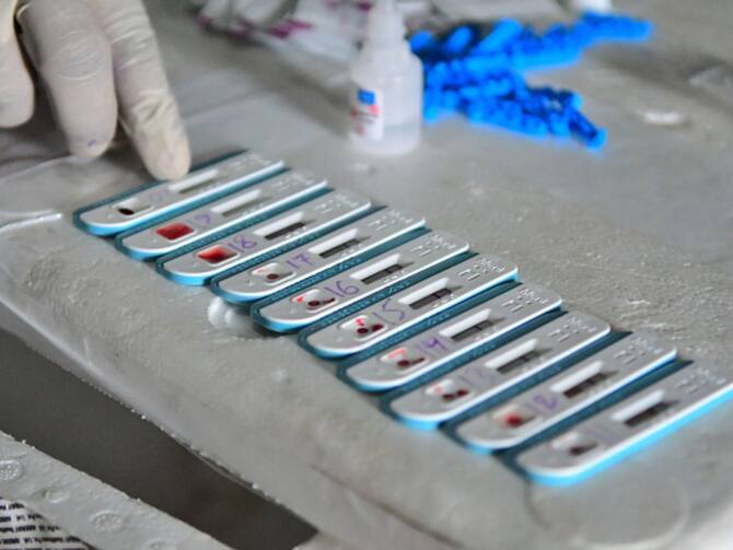 Home Hiv Test Kit Dischem Review Home Co