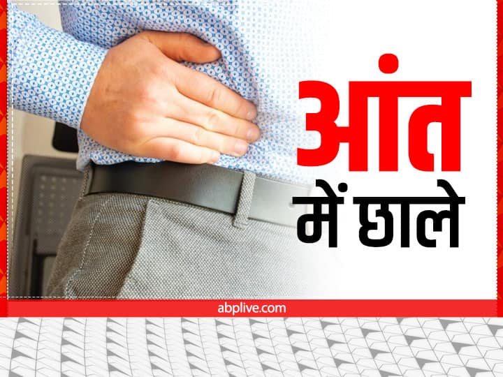 मुंह के साथ आंत में भी हो जाते हैं छाले, जानें क्या होता है क्रोन रोग और इसके कारण