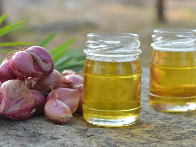 Is This Onion Water Hack the Secret to Healthy Hair? Health Tips: தலைமுடி அடர்த்தியாக வளர்வதற்கு வெங்காயச்சாறு சிறந்த மருந்து: இத்தனை வழிமுறைகளா?