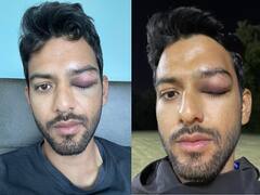Unmukt Chand Injury: बाल-बाल बचे उन्मुक्त चंद, आंख में आई गंभीर चोट; फोटो शेयर कर लिखी मन की बात