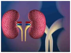 आपकी इन 10 आदतों की वजह से डैमेज हो सकती है किडनी, समय रहते हो जाएं सतर्क