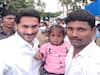 CM Jagan : సీఎం జగన్  ఉదారత, చిన్నారి వైద్యానికి కోటి రూపాయలు మంజూరు