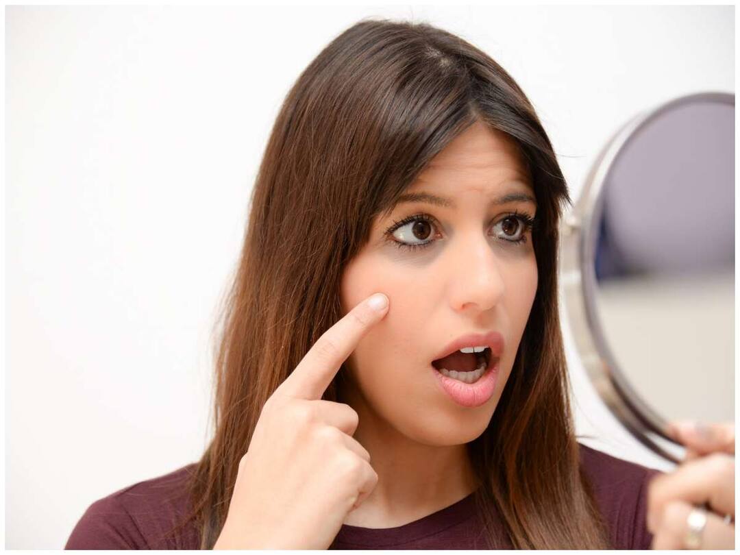 మీ ముఖంలో ఈ మార్పులు వచ్చాయా? థైరాయిడ్ ఏమో చెక్ చేసుకోండి Have these changes occurred in your face? Get your thyroid checked మీ ముఖంలో ఈ మార్పులు వచ్చాయా? థైరాయిడ్ ఏమో చెక్ చేసుకోండి