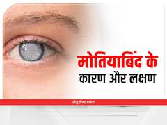 परेशानी का सबब बन सकती है मोतियाबिंद की परेशानी, जानें लक्षण और कारण