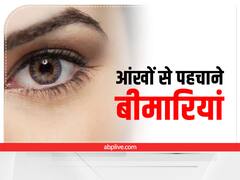 आंखें बताती हैं आपके शरीर का हाल, जानें कैसे बदलता रंग देता है बीमारी का संकेत