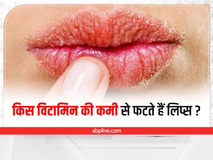 Are dry lips a symptom of anything? Hindustan News Hub
